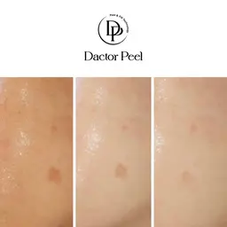 ララピールの進化版の第5世代ピール【ダクトピール】初回特別価格