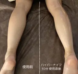 【初回下半身】結果重視！浮腫だるさ撃退☆ ハイパーナイフ＆リンパ脚やせコース(45分)