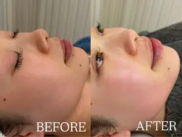 艶肌✨フェイシャルワックス🍯