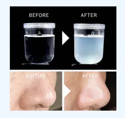 【毛穴黒ずみ】ハイドロフェイシャル✨水素洗浄で毛穴の汚れを根こそぎ吸引！！パスリルにて鎮静&毛穴引き締めツルツル美肌に✨