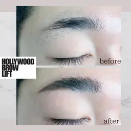 ハリウッドブロウリフト