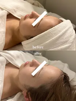 〈人気NO1✨〉 暖かい石膏パックで陶器肌へ🤍 毛穴引き締め・ハリ・ニキビ跡に|肩首リンパ×小顔マッサージ 60分