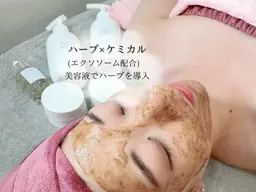 🩵minimoセール🩵【 剥離なし!!ハーブピーリング×ポレーション 】シミ･肝斑･毛穴