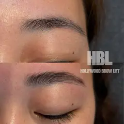 【女性】眉癖改善ハリウッドブロウリフト