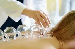 カッピング 15分+整体30分