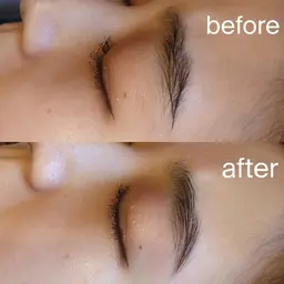 ハリウッドブロウリフト