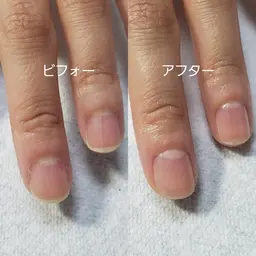 ウォーターケア