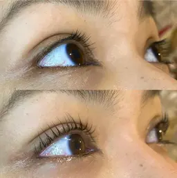 初回リフトカール(ビューラー式)