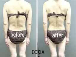 【最強痩身☆】背面半身コース初回価格!!背中→足裏まで背面中心メニュー!!首肩・背中の疲れも◎