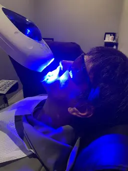 セルフホワイトニング(8分×2)