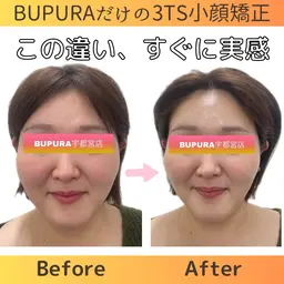 【BUPURA式頭蓋骨小顔骨格フェイシャル】