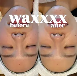【waxxxx】💖フェイシャルワックス💖お肌つるつる🥹✨