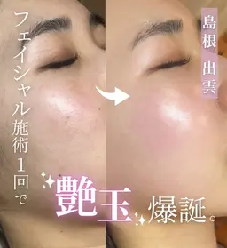 【乾燥／カサつき】粉ふき知らずのしっとり肌へ✨️¥11,000→¥5,500