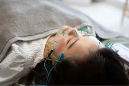 エラ張り解消💥美容鍼＋小顔マッサージ＋デコルテ•首肩マッサージ