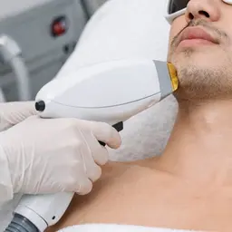 [ミニモ学割U24]メンズ顔高速光脱毛　ヒゲ・頬・口周りなど顔全体の産毛やムダ毛をケアし、自己処理による肌荒れ軽減。