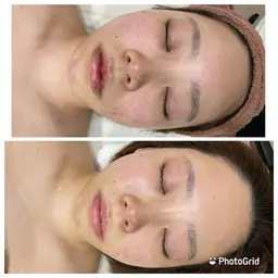 平日限定!目指せ【陶器肌&小顔&美白】✨