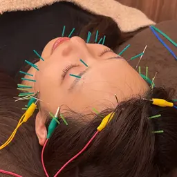 【迷ったらこれ🔰】美容鍼50本🪡+小顔マッサージ