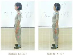 整体コース(首、肩、腰がつらい方、姿勢が悪くカラダの歪みが気になる方、朝起きても疲れがとれていない方にオススメ)