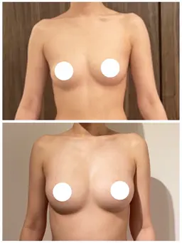 【産後のバストケアもお任せください！】産後前よりもふわぷるバストへ♪