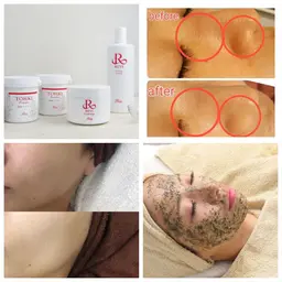 ブライダルエステ👰‍♀️💍REVI剥けないハーブピーリング🌿【フェイシャル】90分通常16500円→4400円