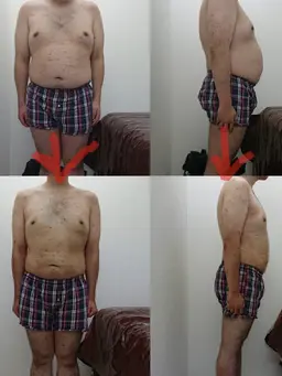 120分×(3回来店)マシン痩身がっつりサイズダウン短期集中コース