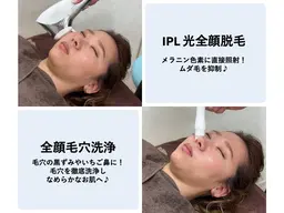 【毛穴洗浄+全顔光脱毛】ツルツル!毛穴もムダ毛もキレイに♪黒ずみ鼻にも◎