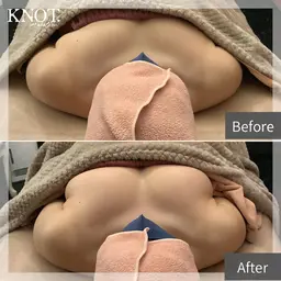 【新規限定】バストUP♡上半身丸ごと美シルエット!自信のデコルテバストライン♥️最新機器NRプリンセスバスト♡スペシャル