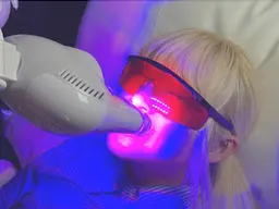 【ミニモ学割】セルフホワイトニング(10分照射✕2回) 1970円