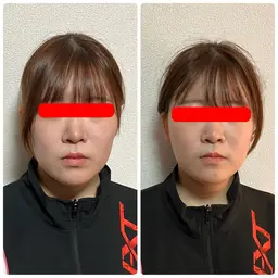 新規のお客様限定❗️小顔・美ボディ　全身集中コース（120分）