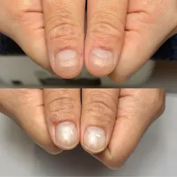 【毎月2名様限定】爪の悩み、そっと打ち明けてみませんか?|お悩み相談&施術体験