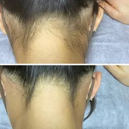 👱‍♀️女性【撮影モニター】うなじWax/SNS等に掲載可能な方