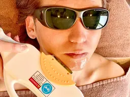 ◆メンズ◆カミソリ負け解消🔥ヒゲ脱毛