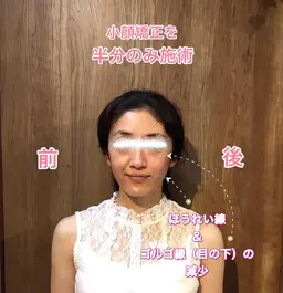 むくみ撃退、歪み改善!!小顔矯正