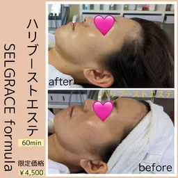 🧡ハリブーストエステ🧡EMSでハリUPエイジングケア
