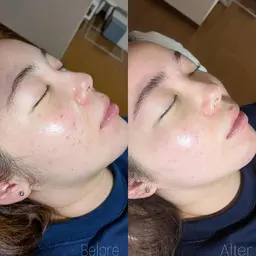 フェイスワックス