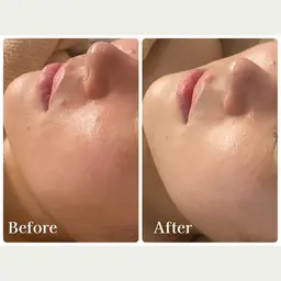 ＼脳疲労ケア70分／【ドライヘッドスパ・耳・首・肩・顔・デコルテ・背中・二の腕】 +肌ケアピーリング付き