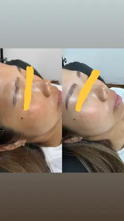 次世代アイブロウ【ハリウッドブロウリフト】技術向上の為モデル価格にて施術可能 (13:00まで限定価格)