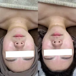 韓国ツヤ肌に【韓国肌管理☆水光艶肌フェイシャル(デコルテ+ヘッド付)60分】¥12000