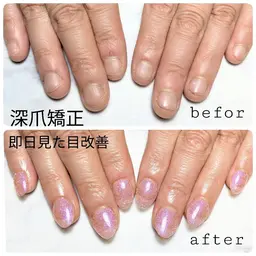深爪矯正(ジェルオフorスカルプオフあり)スカルプ+ワンカラーorラメグラ+ネイルケア+ネイルオイルプレゼント