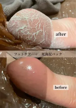 角質ケア＆パラフィンパック