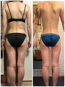 ミニモ初回期間限定🙌🏻💕 全身痩身エステ ✴︎お腹 ✴︎背中 ✴︎ヒップ ✴︎脚