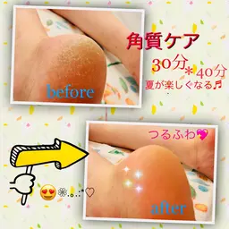 🦶🦶✨💖足裏角質ケア40分フットネイルも似合う美脚💕つるぴかな足裏で気分も上がる♬美容と健康の為のフットケアです