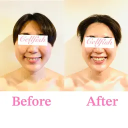 【小顔矯正✖️美肌フェイシャル】小顔とツヤ肌が一度で叶う✨お顔のむくみ・たるみ・ほうれい線・もたつきが気になる方へ❣️