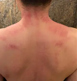 【体験、お試し】オリジナル刮痧　スペシャルコース　(かっさ＆ほぐしMIX  全身　約120分、足湯付き)