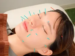 【🌈ベーシック美容鍼🌈】美容鍼20本➕温熱ケア➕ローラー鍼➕ヘッドマッサージ🌿　60分