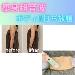 強力痩身★超音波W打ち放題《二の腕orウエストorふくらはぎ》¥10500