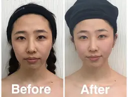 コルギモニター5回券(初回のみCRあり)みっちり50分🎶お顔もお身体もケア♡