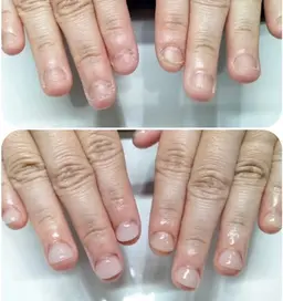 【ミニモ限定】職場・ネイル禁止🙆♀️|自然な深爪矯正(長さ出し+クリア)マットも可
