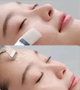 人気No.1‼️【毛穴集中ケア】スッキリとした明るくなめらかでつるんとした肌を目指す方へ。うるおいを与え透明感の肌へ