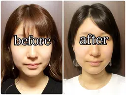 【当日OK🫧】即効むくみ小顔首肩リンパ×フェイスライン引き締め60分